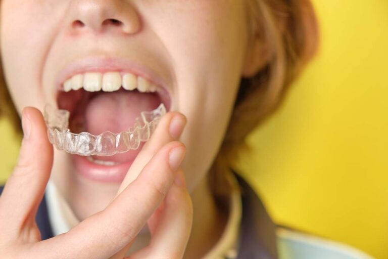 Orthodontics photo from Adobe Stock